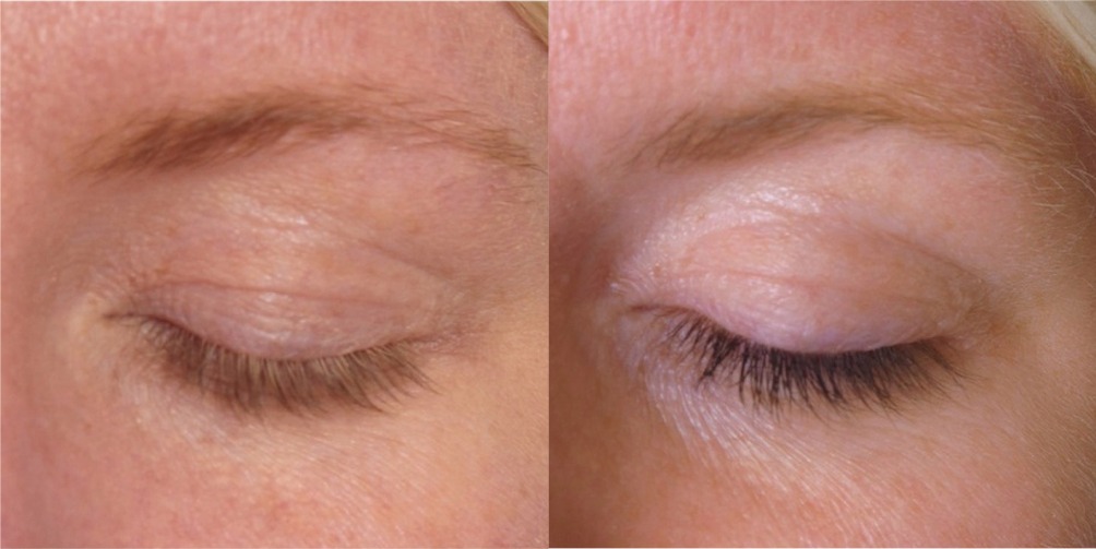 Brows & Lashes | Body Care Center